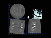 歯科用CTとの組み合わせ